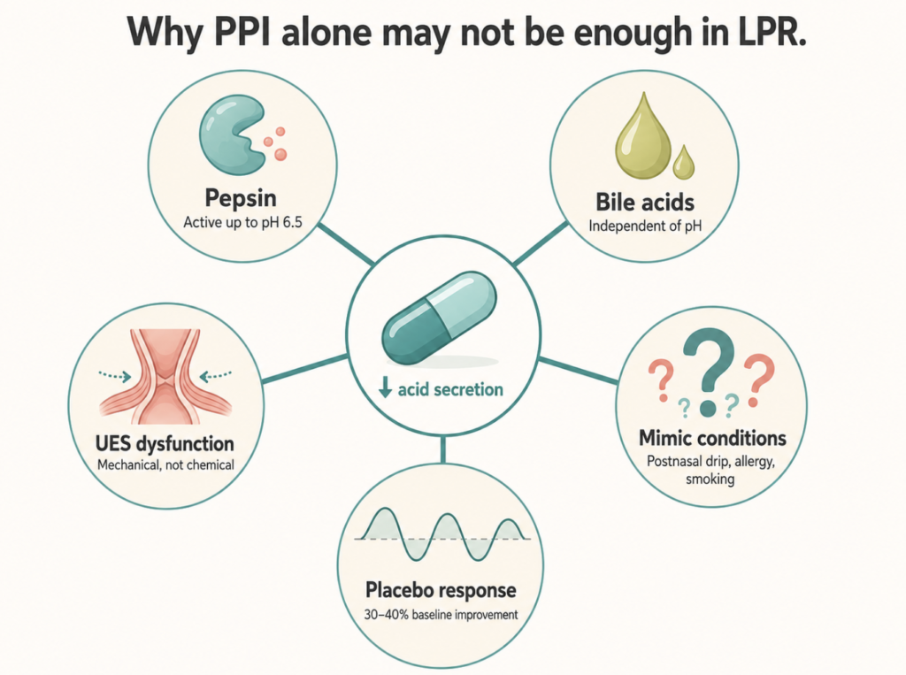 Diagram of five mechanisms that proton pump inhibitors do not address in laryngopharyngeal reflux disease