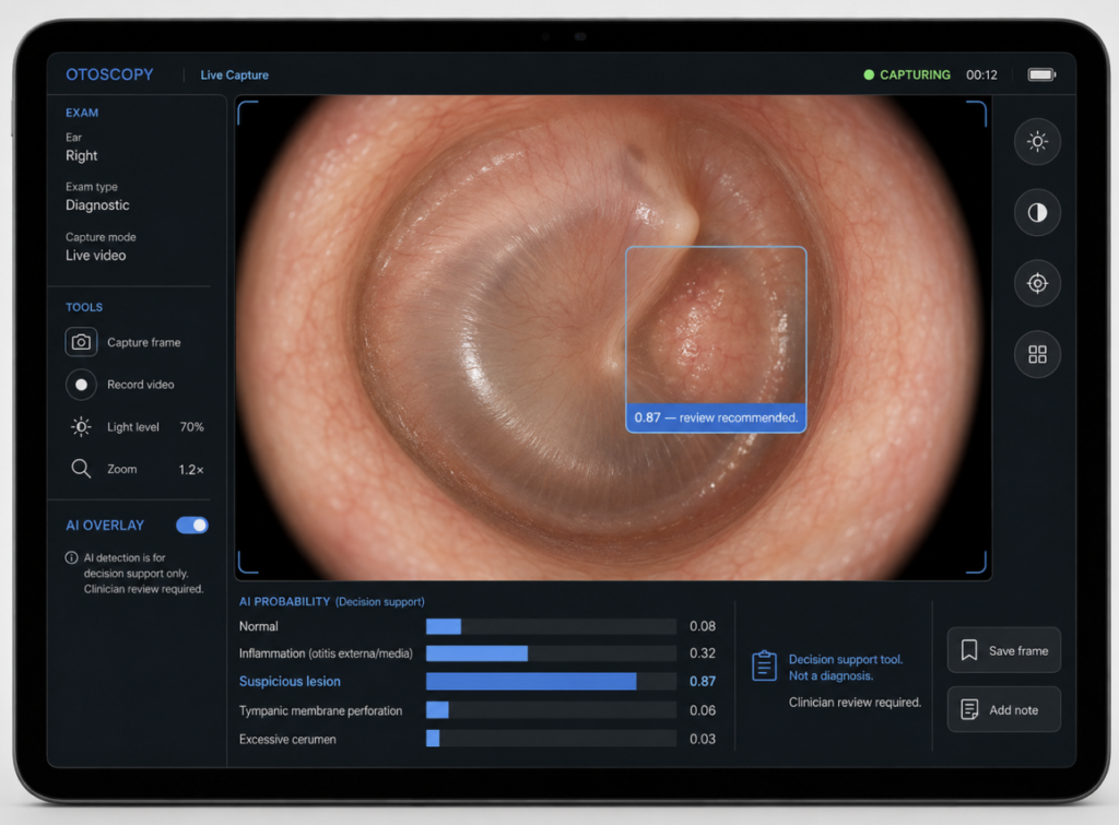 Mock interface mockup of an otoscopy or laryngoscopy capture screen showing a real-time CNN overlay highlighting suspicious regions with a confidence score, framed as a clinician-facing decision support tool rather than an autonomous diagnostic system.
