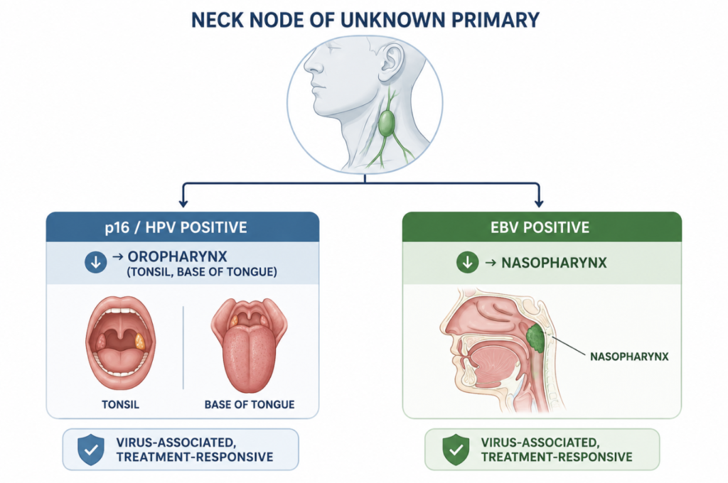 Decision diagram showing HPV/p16-positive neck nodes pointing to an oropharyngeal primary and EBV-positive nodes pointing to a nasopharyngeal primary