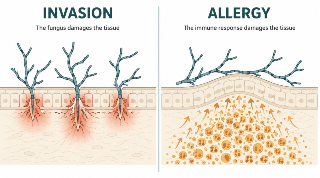 Conceptual illustration contrasting infection and allergy as causes of tissue damage in fungal sinusitis