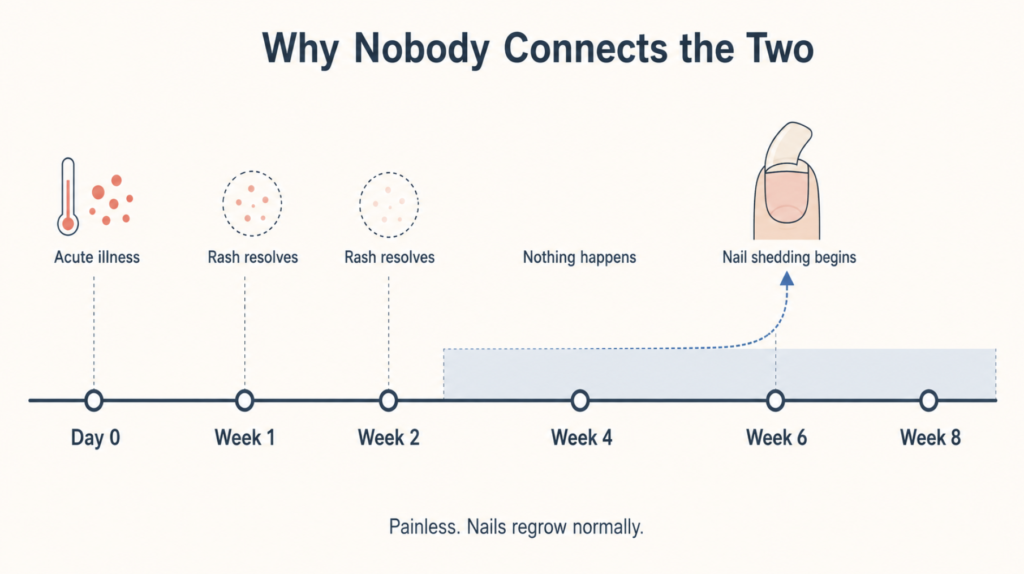 Timeline showing nail shedding beginning about six weeks after hand foot and mouth disease, long after the rash has resolved