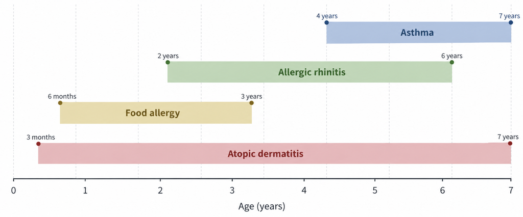 Timeline chart of allergic march stages showing typical onset ages for eczema, food allergy, allergic rhinitis, and asthma