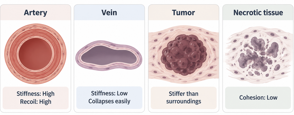 Four cards describing artery, vein, tumor, and necrotic tissue by stiffness, recoil, and cohesion in qualitative high or low terms