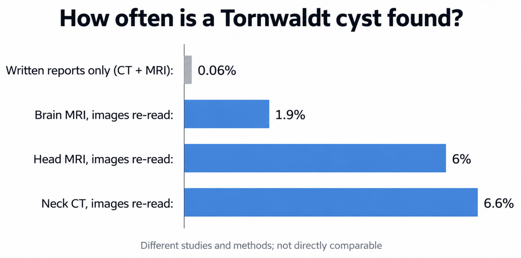 Bar chart comparing Tornwaldt cyst detection rates: 0.06% when only written reports are searched versus 1.9%, 6%, and 6.6% when MRI and CT images are re-read